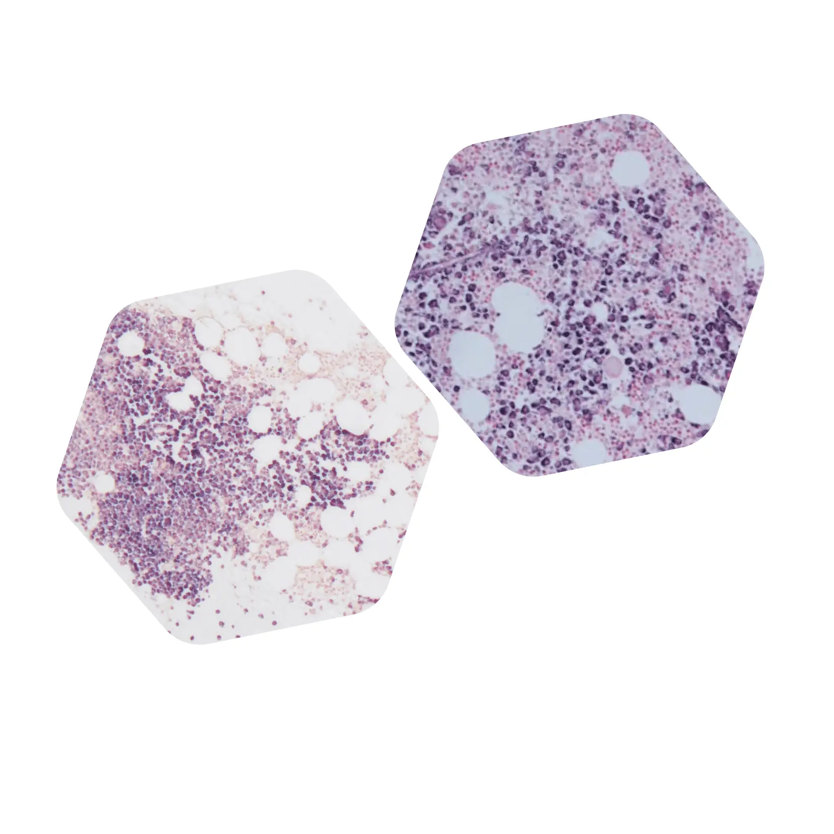 Kappa and Lambda mRNA CISH (Dako Omnis)