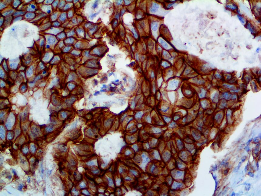P120 Catenin