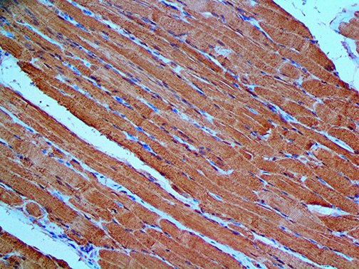 Myoglobin